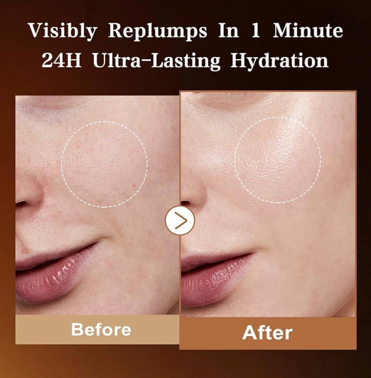 Suero de ácido hialurónico - Image 4